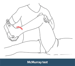 mcmurray-test
