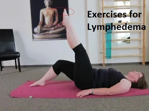 Exercises for Lymphedema