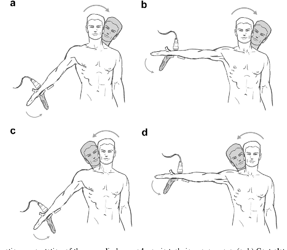 Upper extremity neural mobilization