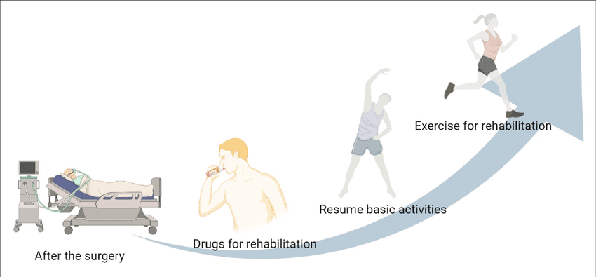 Postoperative-rehabilitation-stages