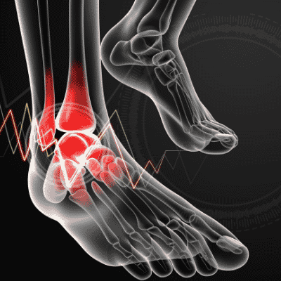 Anterior Ankle Pain (Pain on the front of Ankle)