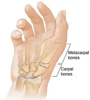 Carpometacarpal Joint