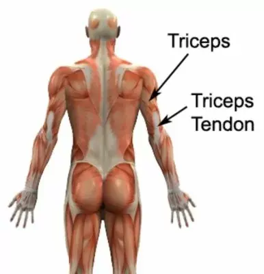 Triceps Tendonitis