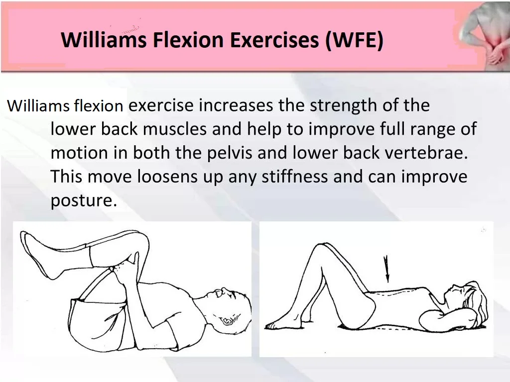 Williams flexion exercises (WFE)