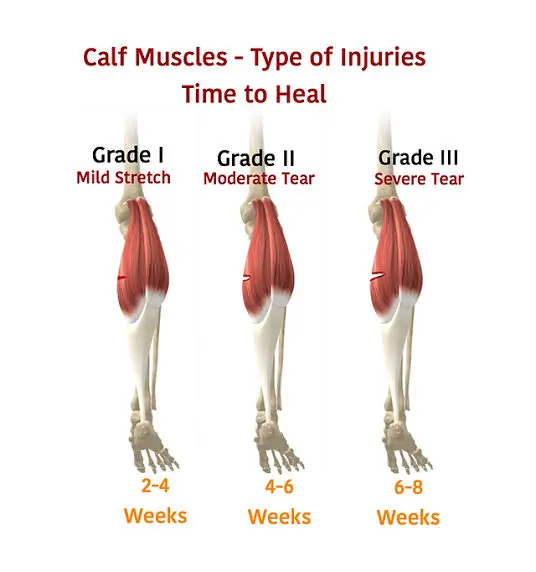 Grading of calf muscle injury
