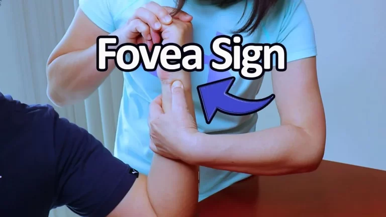 Fovea Sign