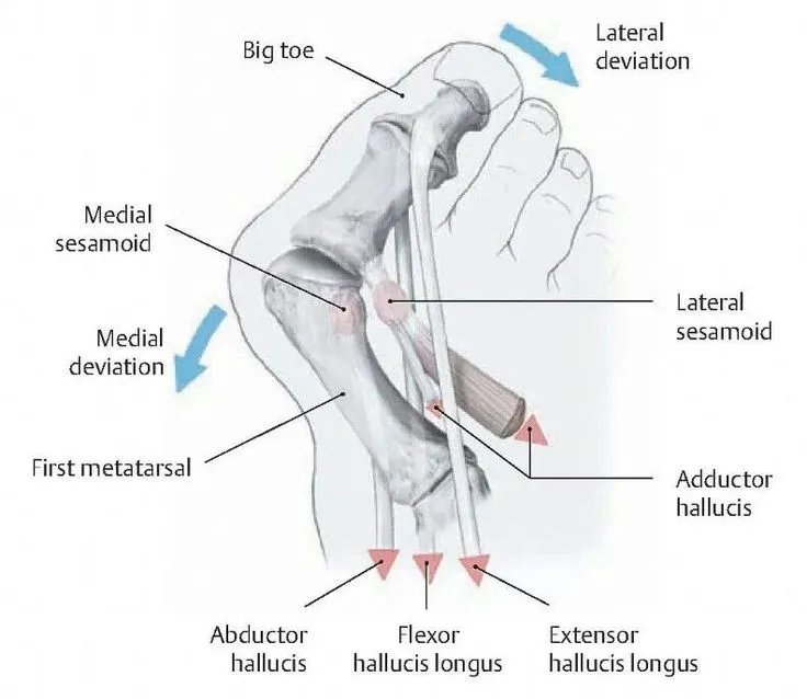 Anatomy-of-bunions