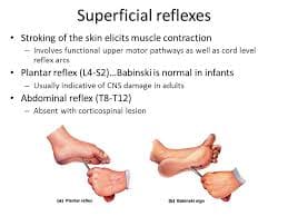 Superficial Reflexes