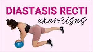 Exercises for diastatic recti