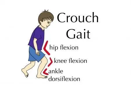 Crouch Gait