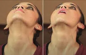 Extended Neck Face Yoga