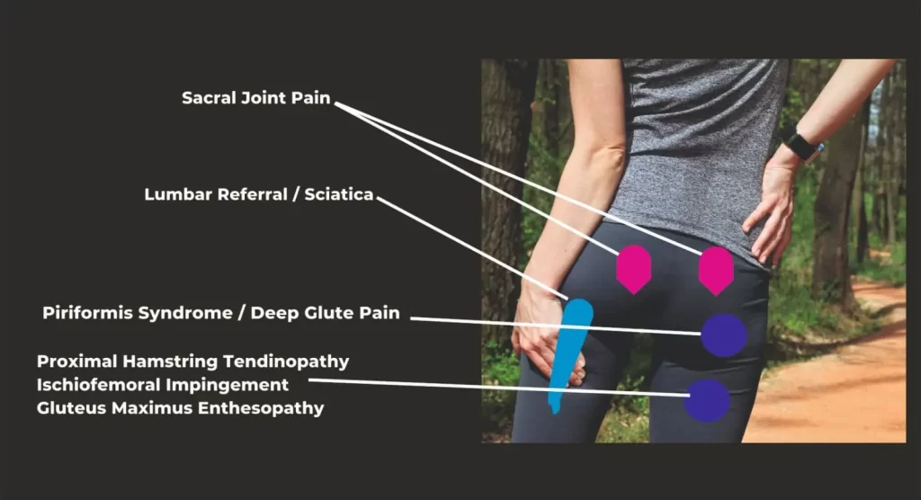 Front Side of the Hip Pain Location Diagram
