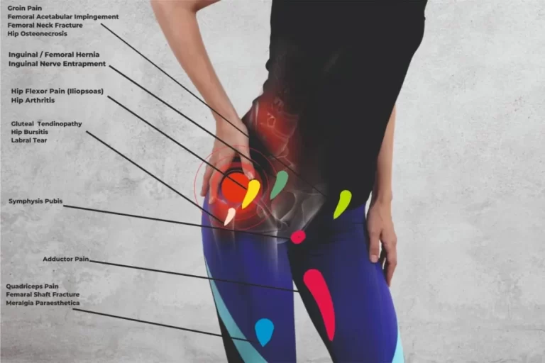 Front Side of the Hip Pain Location Diagram