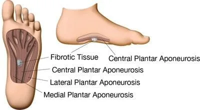 anatomy of Plantar fascia