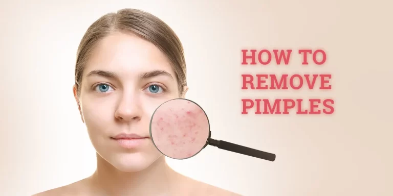 Clear Skin in a Snap: Your Guide to Pimple Prevention and Treatment