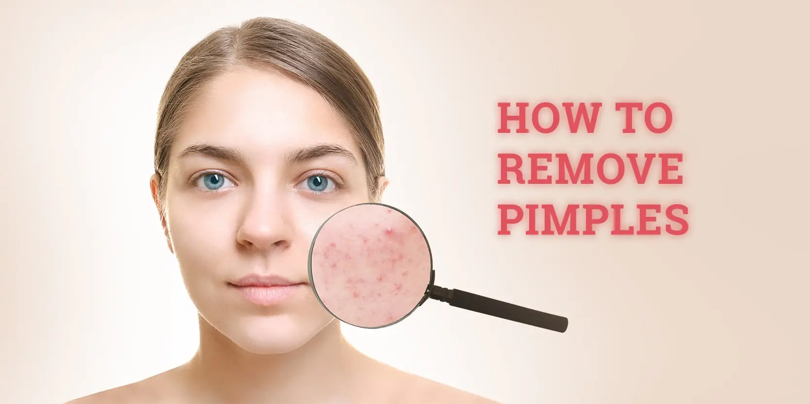 how to remove pimple (acne vulgaris)