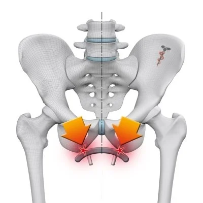 Sit Bone Pain