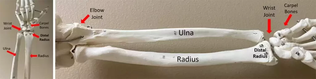 Radius bone