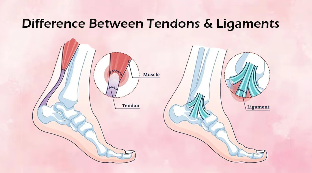 Tendons vs. Ligaments What's the Difference?