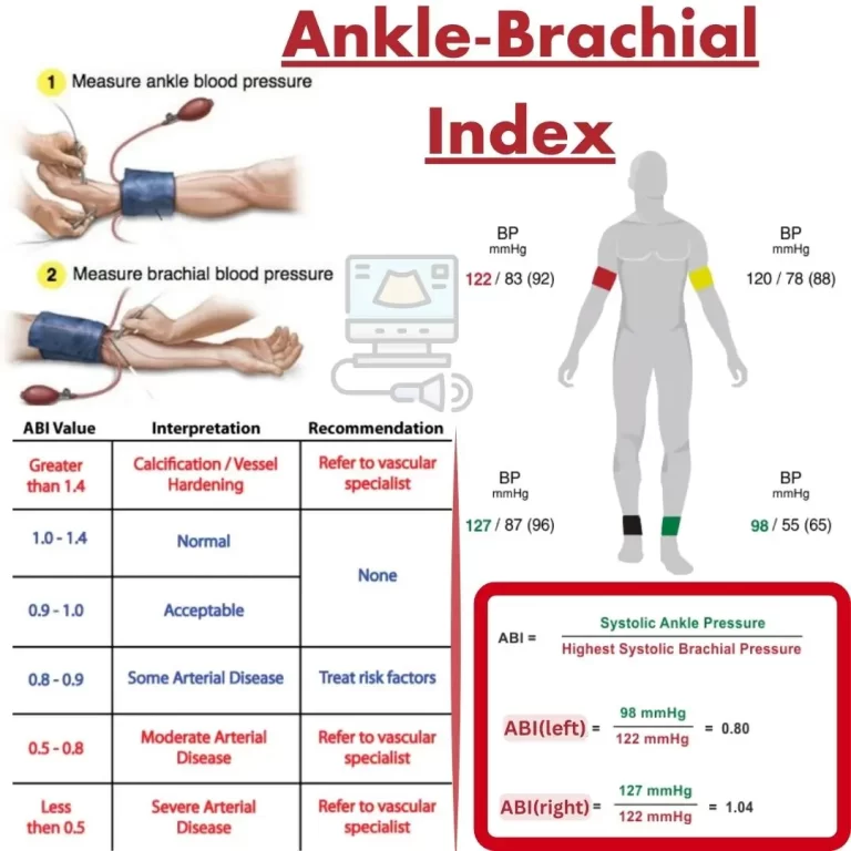 The Ankle-Brachial Index: A Painless Test for Peripheral Artery Disease