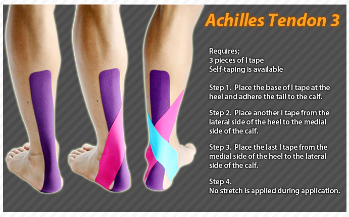 Achilles-tendon-kt-tape