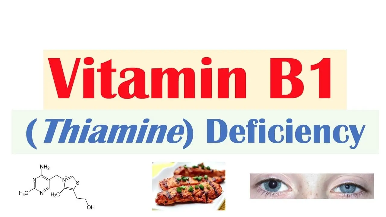 Thiamine (Vitamin B1) Deficiency