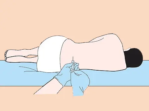 A Lumbar Puncture (Spinal Tap)