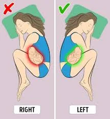 Sleeping on your left or right side while pregnant