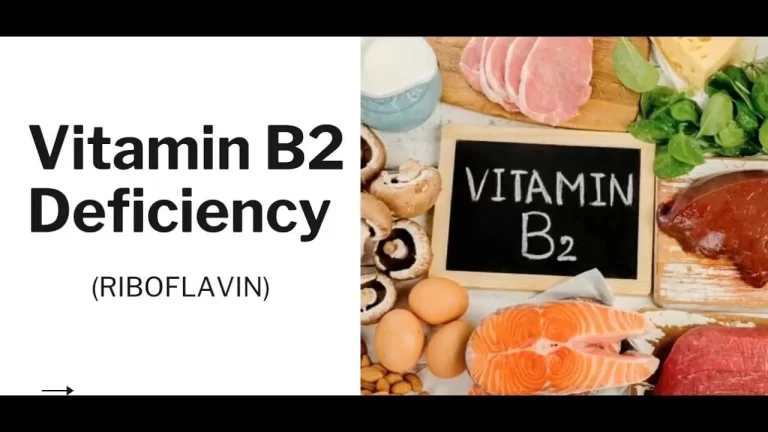 Riboflavin Deficiency (Vitamin B2 Deficiency)