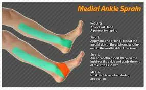 Kt tape for ankle-sprain