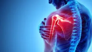 Shoulder Pain: Causes, Treatments & Diagnosis