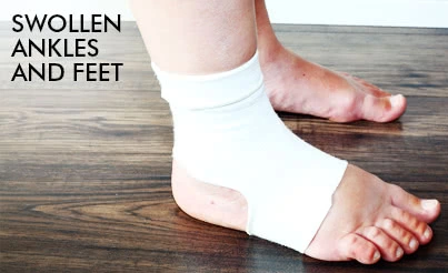 Swollen Feet with Diabetes