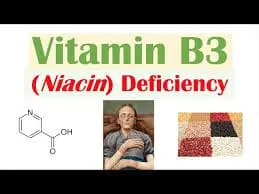 Niacin Deficiency (Vitamin B3 Deficiency)