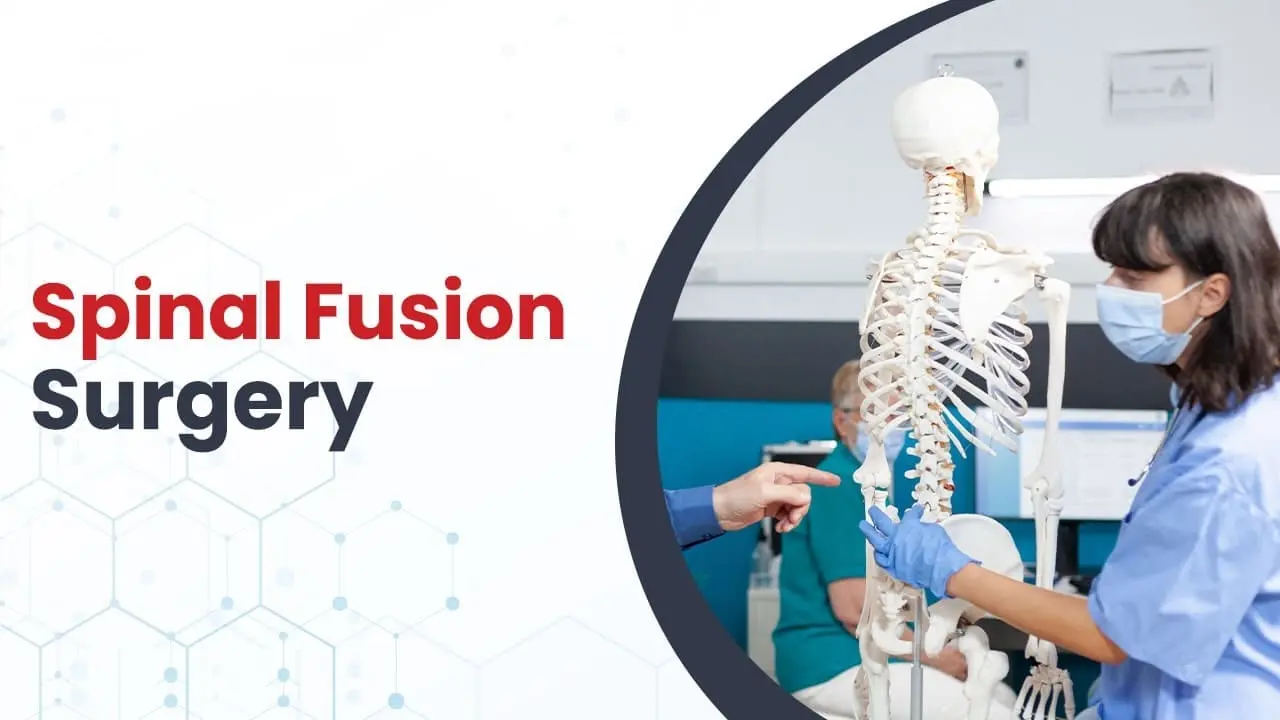 spinal-fusion-surgery