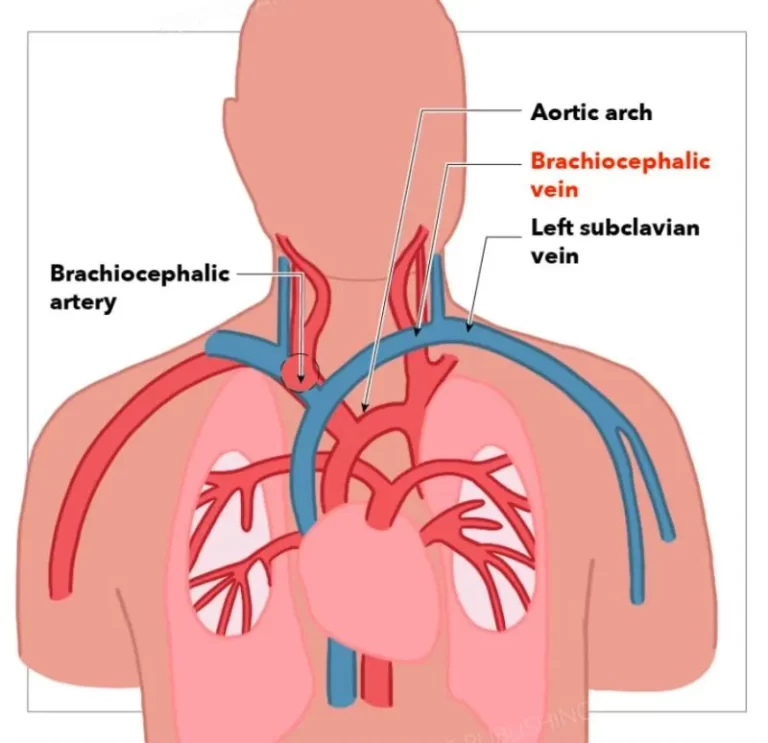 brachiocephalic vein