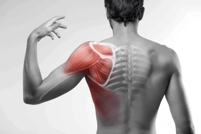 Subscapularis muscle pain
