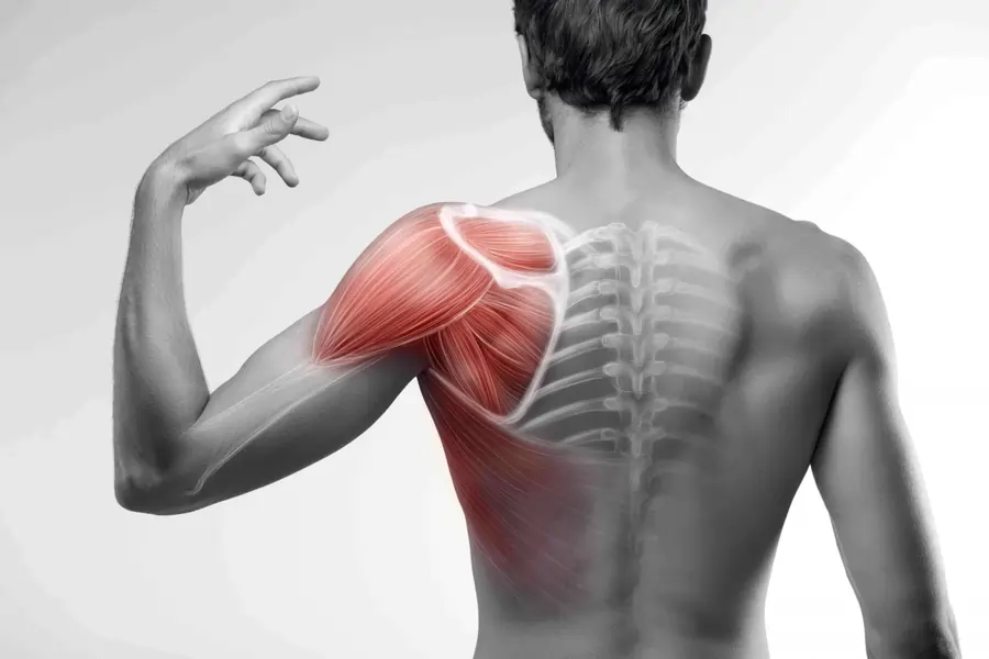 Subscapularis muscle pain